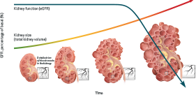 Kidney Function and TKV Over Time